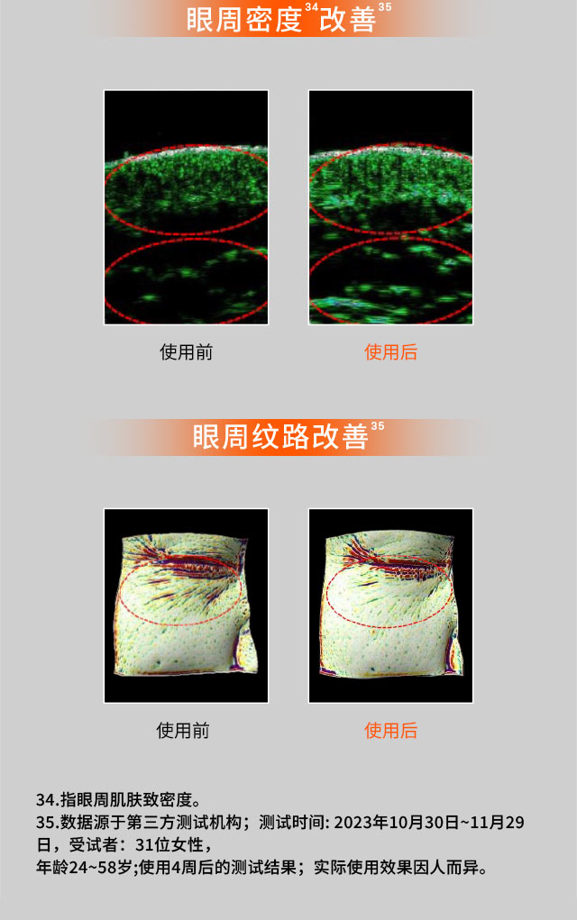 天游ty8线路测试中心人参眼霜